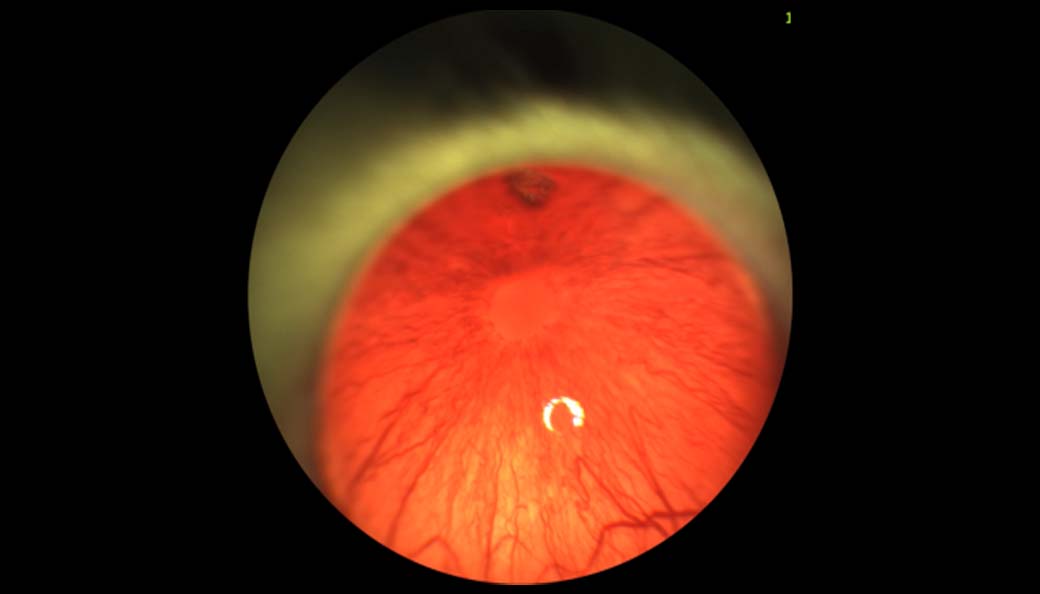 Available Uveitis Models-image